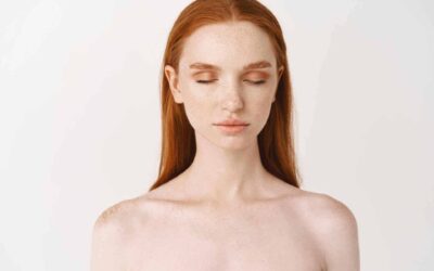Peeling : luttez contre les taches pigmentaires