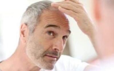 2020 : enfin l’année de vraies avancées scientifiques en matière de calvitie ?