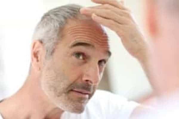 alopecie androgenetique homme calvitie perte de cheveux clinique greffe de cheveux robotisee paris implants capillaires greffe de cheveux the clinic paris