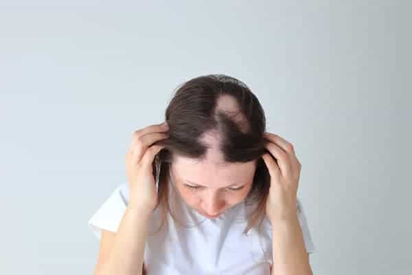 alopecie cicatricielle cause grosse perte de cheveux clinique greffe de cheveux robotisee paris implants capillaires greffe de cheveux the clinic paris