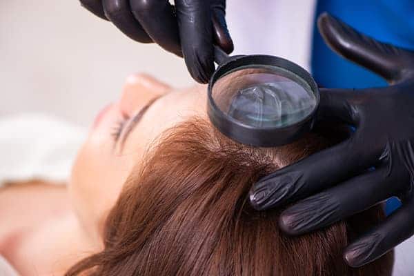 calvitie alopecie androgenetique femme clinique greffe de cheveux paris implants capillaires greffe de cheveux the clinic paris