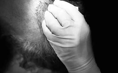 Zone donneuse : capital épuisable !