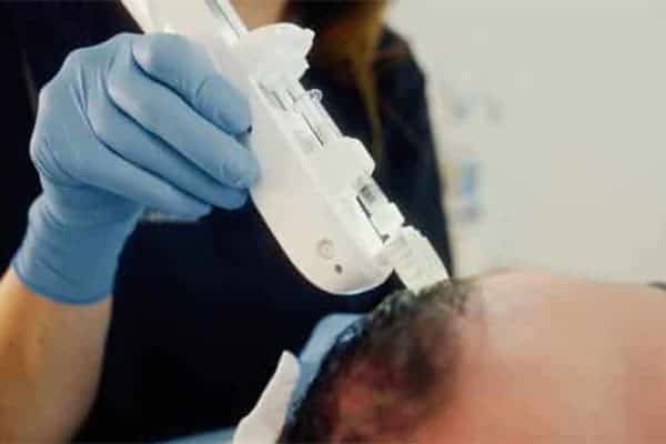 formation n injection peptides greffe capillaire clinique implant capillaire greffe de cheveux the clinic paris