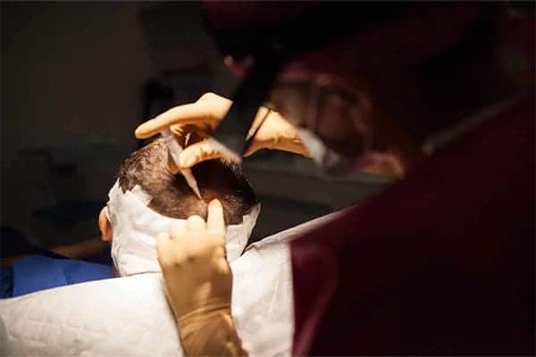 greffe de cheveux robot artas l clinique implants greffons capillaires greffe de cheveux the clinic paris
