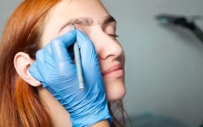 La greffe de sourcils de Chrissy Teigen