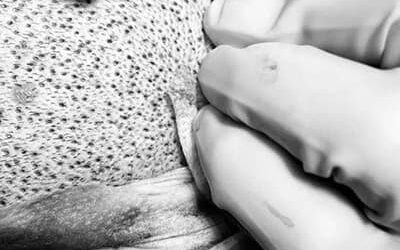 Greffe de Cheveux : qui fait quoi ?