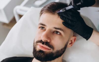 Greffe de cheveux : faut-il être riche et célèbre pour avoir de bons résultats ?