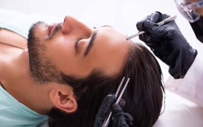 Peut-on vivre normalement après une greffe de cheveux ?