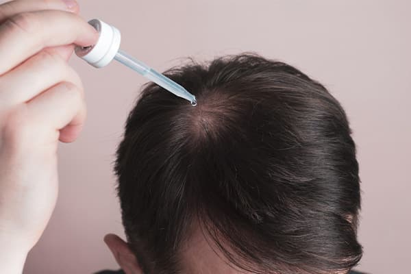 traitement effluvium telogene cheveux homme alopecie androgenetique grosse perte de cheveux clinique greffe de cheveux robotisee paris implants capillaires greffe de cheveux the clinic paris