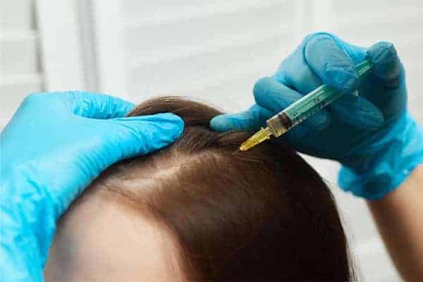 injection cheveux avant apres paris the clinic paris expert implants capillaire greffe de cheveux barbe france injection cheveux paris