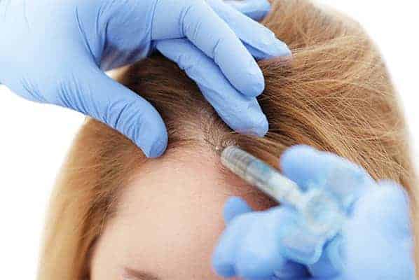 mesotherapie cheveux avant apres resultat the clinic paris expert implants capillaire greffe de cheveux barbe france injection cheveux paris