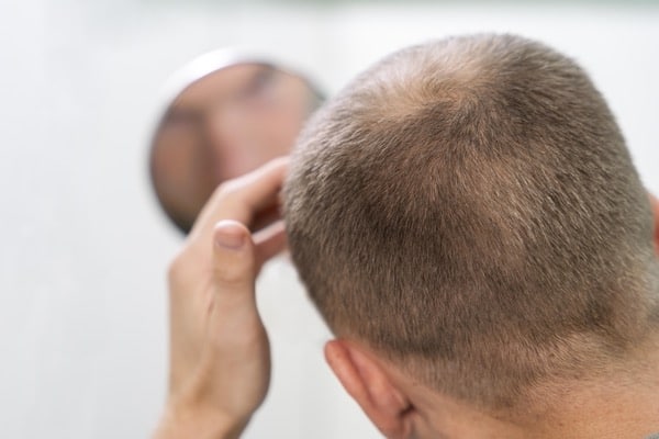 espoir traitement calvitie cellules souches repousse cheveux science the clinic paris