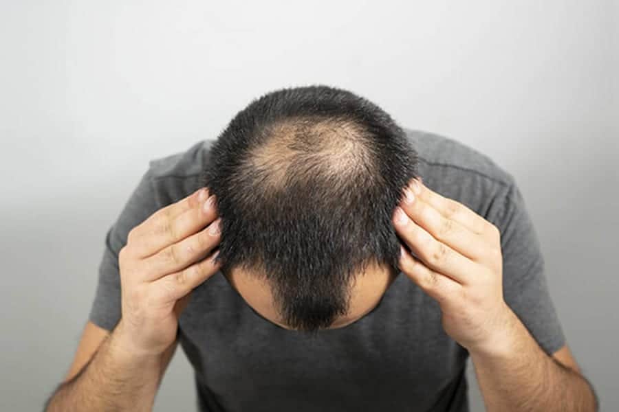 greffe qui ne prend pas greffe ratée alopecie androgenetique clinique greffe de cheveux robotisee paris implants capillaires greffe de cheveux the clinic paris