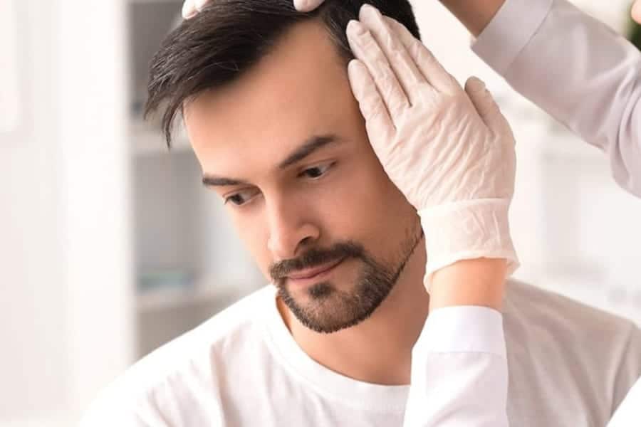 greffe de cheveux une seule ou plusieurs duree definitive implants capillaire long terme paris the clinic