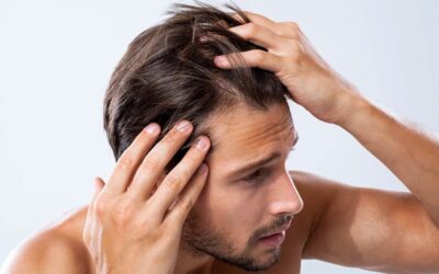 Combien de temps dure le résultat d’une greffe de cheveux ?