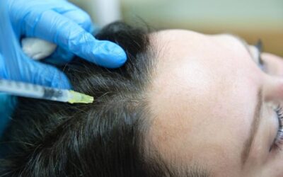 Mésothérapie pour les cheveux : quel tarif ?