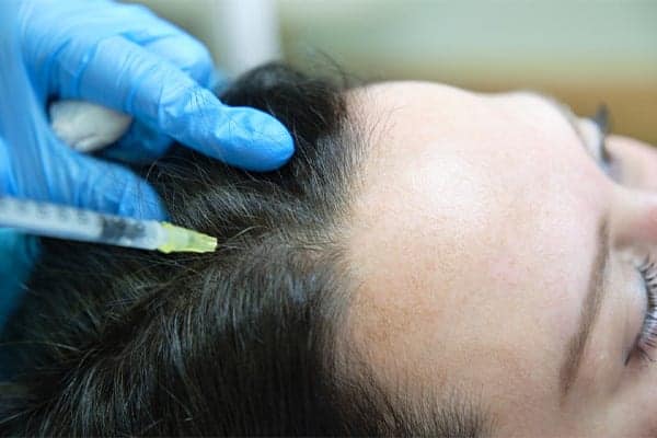 mesotherapie the clinic paris expert implants capillaire greffe de cheveux barbe france injection cheveux paris
