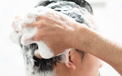 Quel shampoing après une greffe de cheveux ?