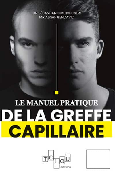 livre greffe capillaire dr sebastiano montoneri mr assaf bendavid