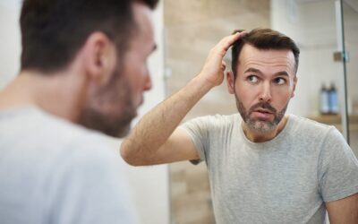 À quel âge faire une greffe de cheveux ?