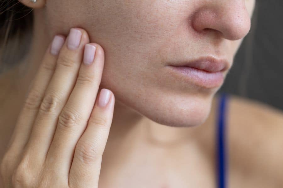 laser fraxel avant apres resultats traitement esthetique peau specialiste peeling visage paris the clinic medecine esthetique paris