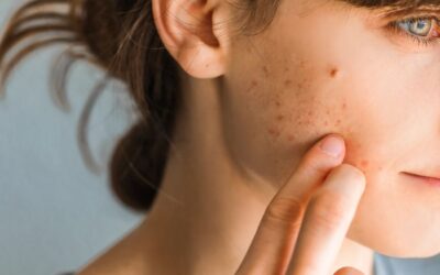 Peeling du visage avant et après : à quels résultats s’attendre ?
